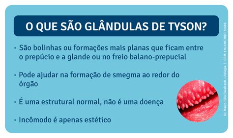 glandulas tyson o que é|Glândulas de Tyson: o que são e os problemas que。